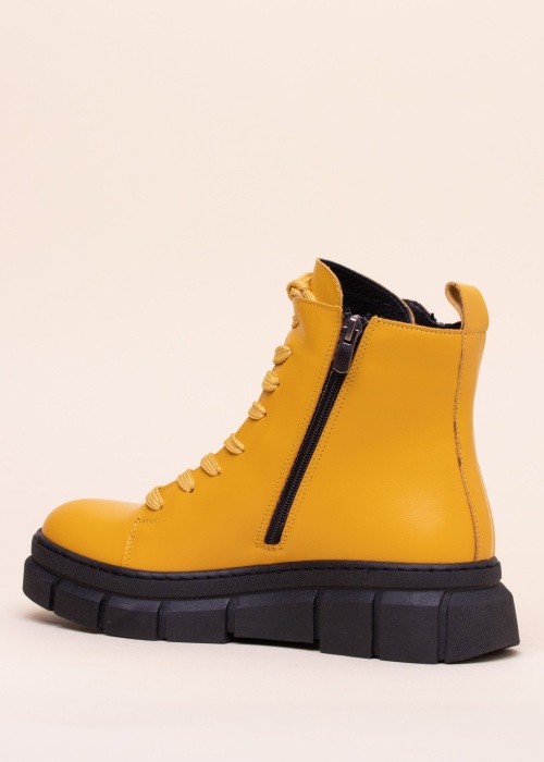 Loretta Vitale puszābaki