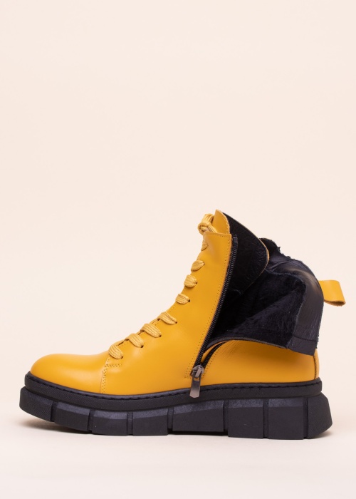 Loretta Vitale puszābaki