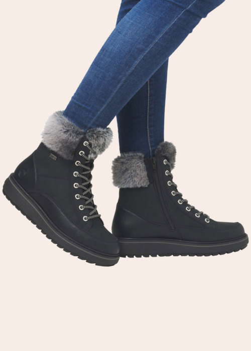 Remonte puszābaki ar radzēm