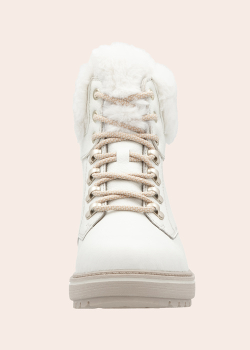 Remonte puszābaki ar radzēm