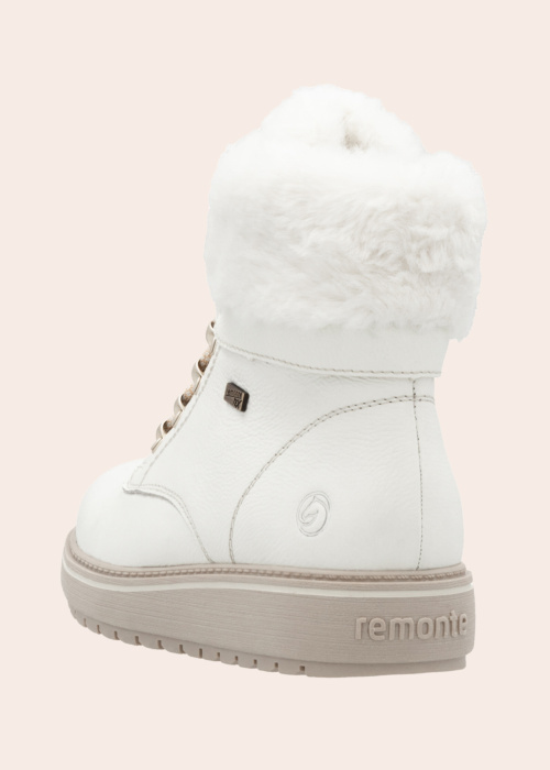 Remonte puszābaki ar radzēm