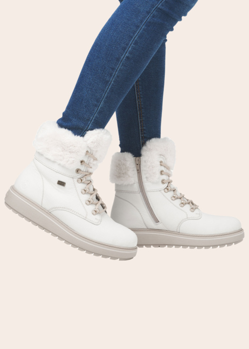 Remonte puszābaki ar radzēm