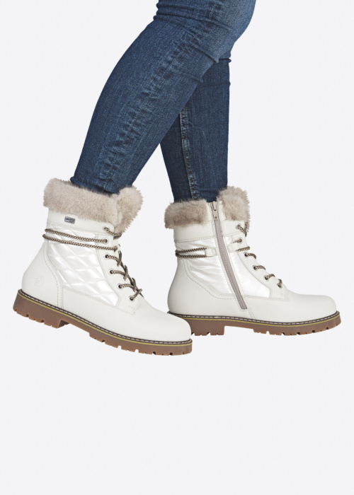 Remonte puszābaki ar radzēm