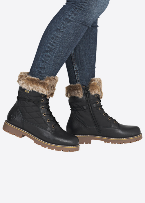 Remonte puszābaki ar radzēm