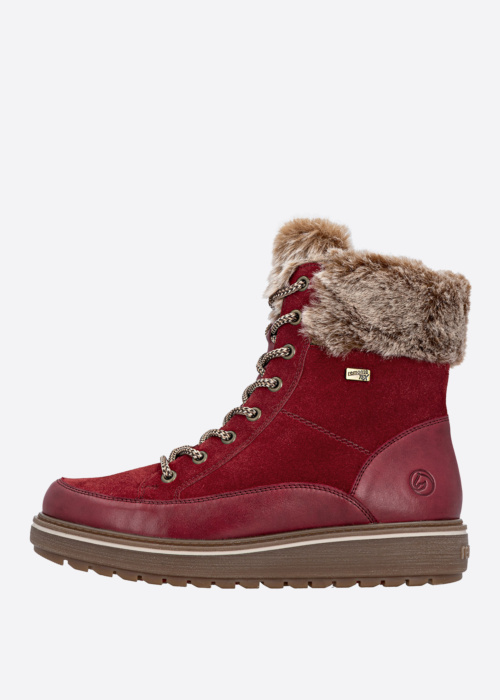 Remonte puszābaki ar radzēm