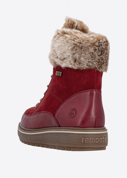 Remonte puszābaki ar radzēm