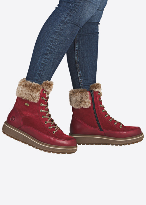 Remonte puszābaki ar radzēm