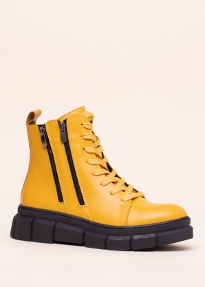 Loretta Vitale puszābaki