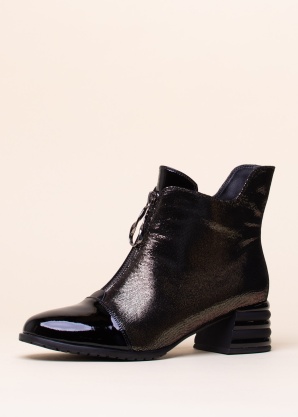 Loretta Vitale puszābaki